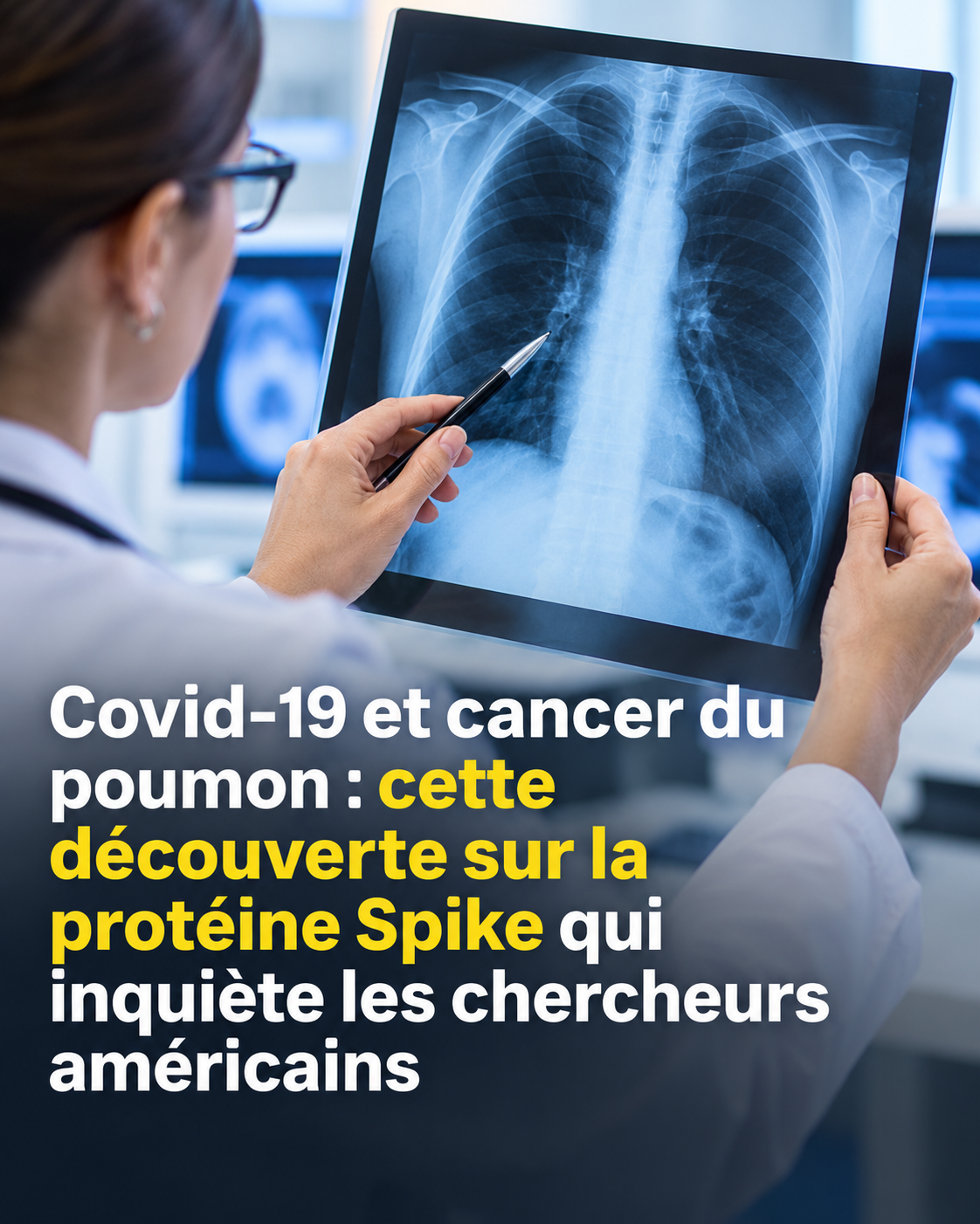 Covid-19 et cancer du poumon : ce que les chercheurs ont découvert sur la protéine Spike