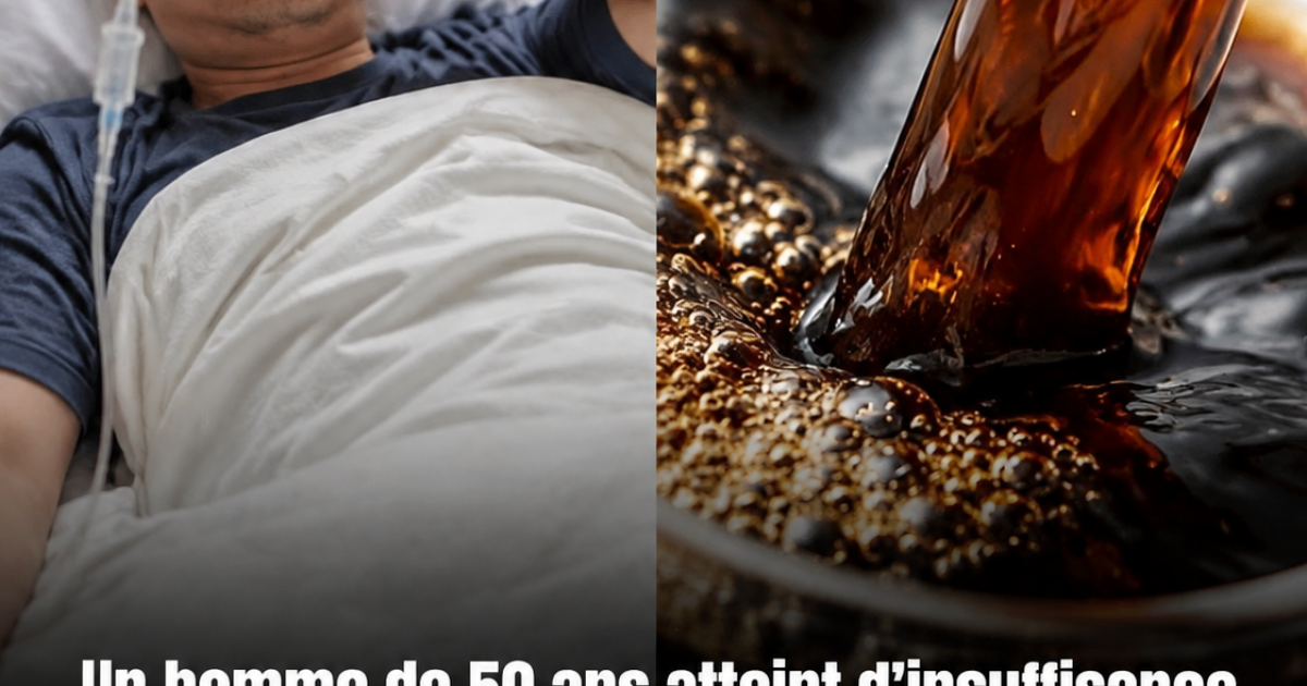 Insuffisance rénale : son café du matin était-il vraiment coupable ? Ce que les médecins ont découvert