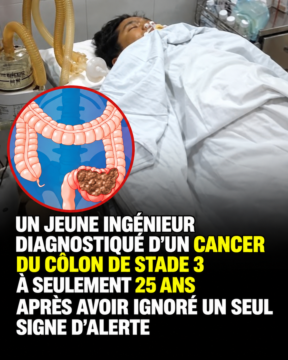Il avait 25 ans et ignorait ce signe du quotidien : le diagnostic a tout changé