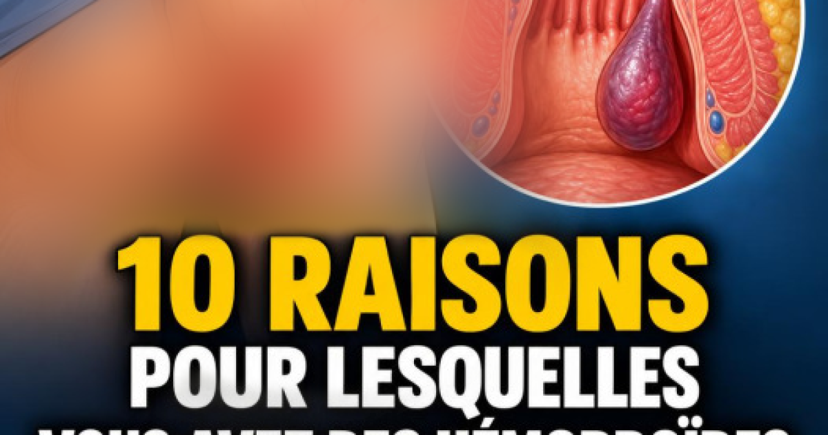 Hémorroïdes : pourquoi elles apparaissent et comment s'en débarrasser efficacement