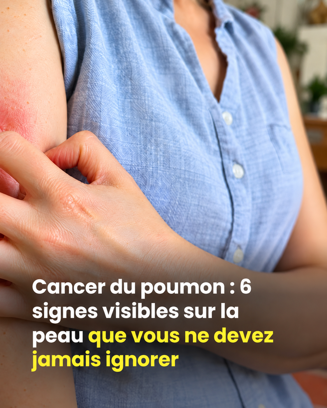 Cancer du poumon : ces 6 signes visibles sur la peau que vous ne devez pas négliger