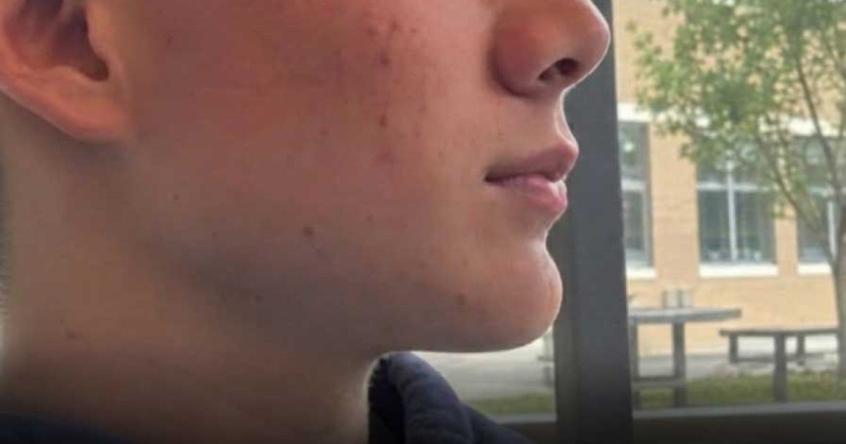 Sam, 18 ans, autiste et brillant étudiant : le drame qui interpelle toute une société