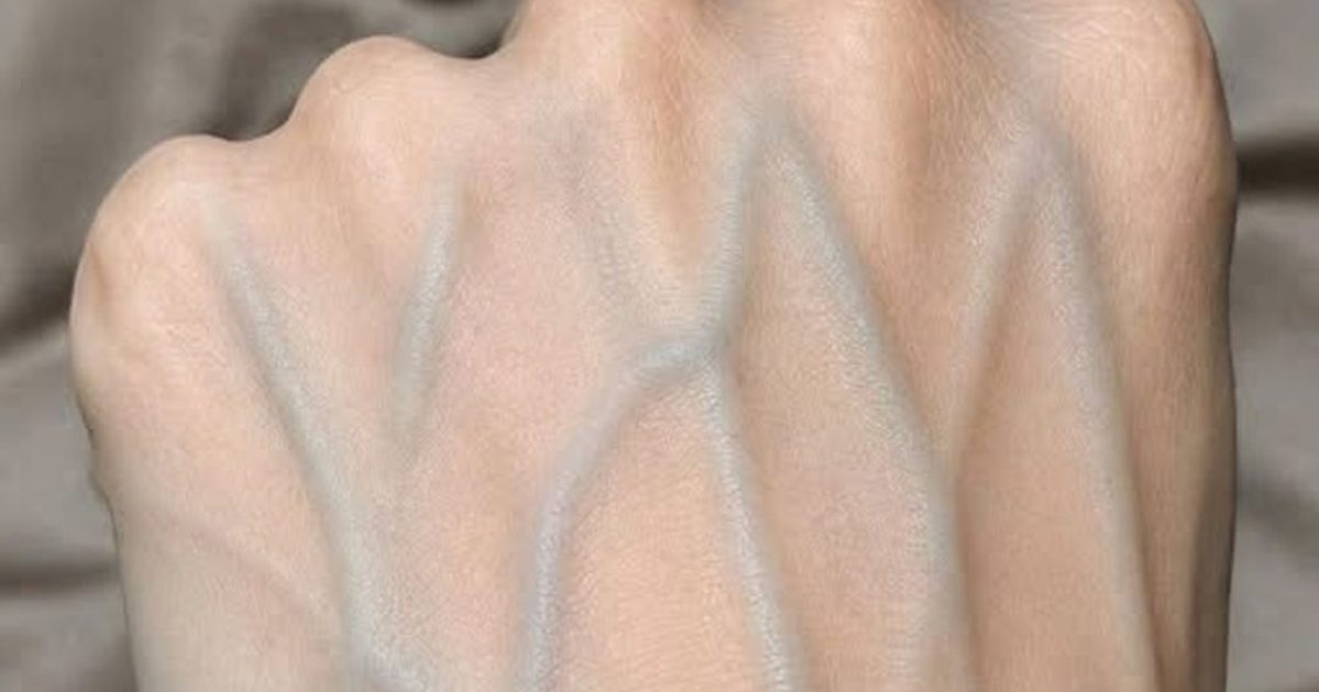 Veines apparentes sur les mains : ce que votre corps essaie vraiment de vous dire