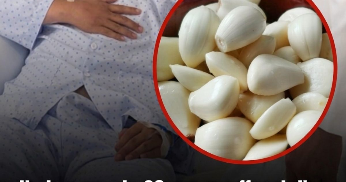 Il a mangé de l'ail tous les jours pendant 5 mois : voici ce que les médecins ont constaté sur ses reins