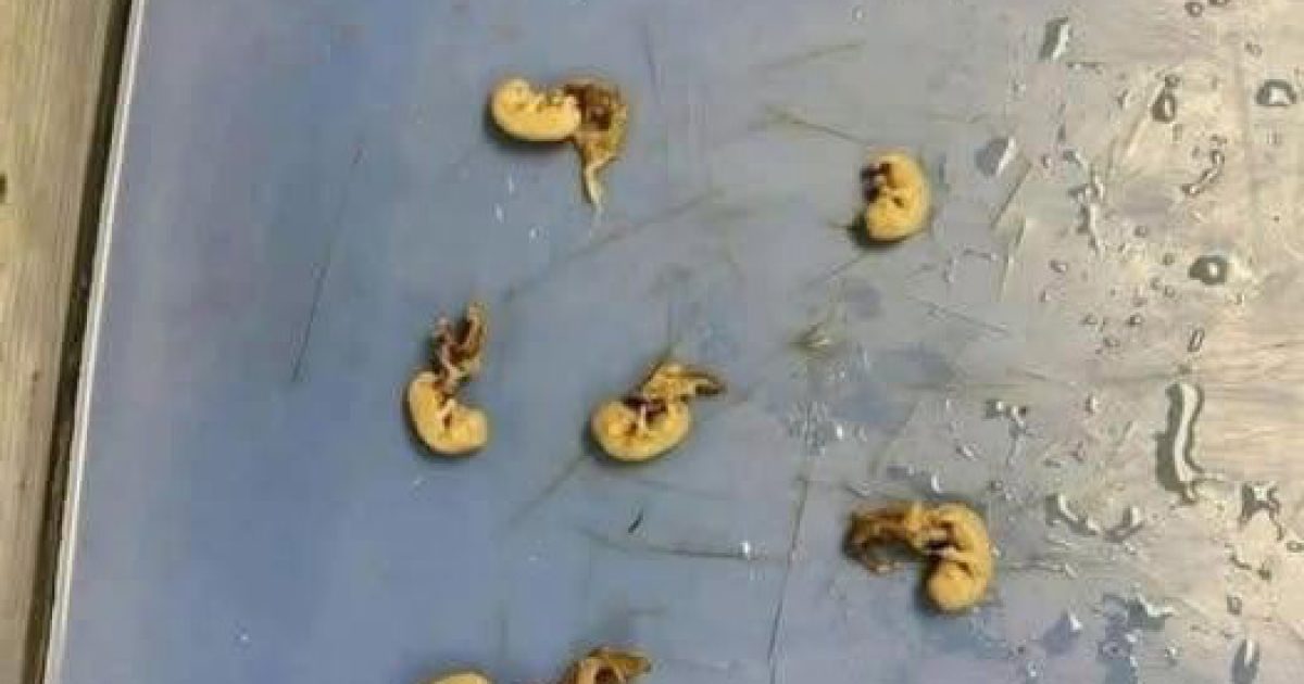 Ces graines qui se cachent dans vos snacks : ce qu'il faut vraiment savoir avant d'en manger
