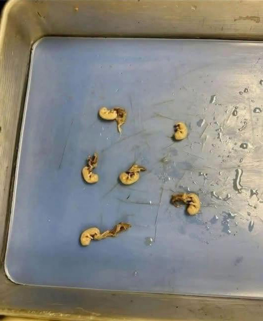 Ces graines qui se cachent dans vos snacks : ce qu'il faut vraiment savoir avant d'en manger
