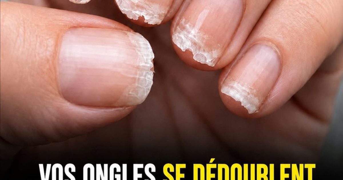 Ongles cassants ou qui se dédoublent : ce que votre corps essaie vraiment de vous dire