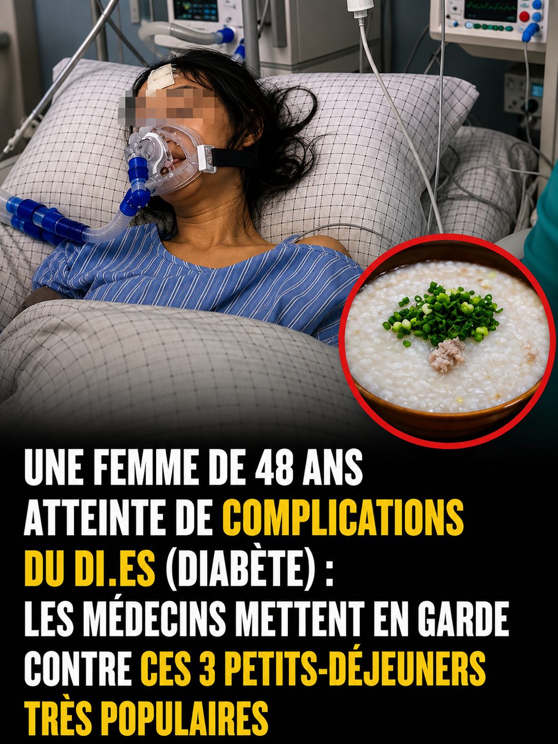 Ces 3 aliments du petit-déjeuner que les médecins conseillent de limiter pour préserver sa glycémie