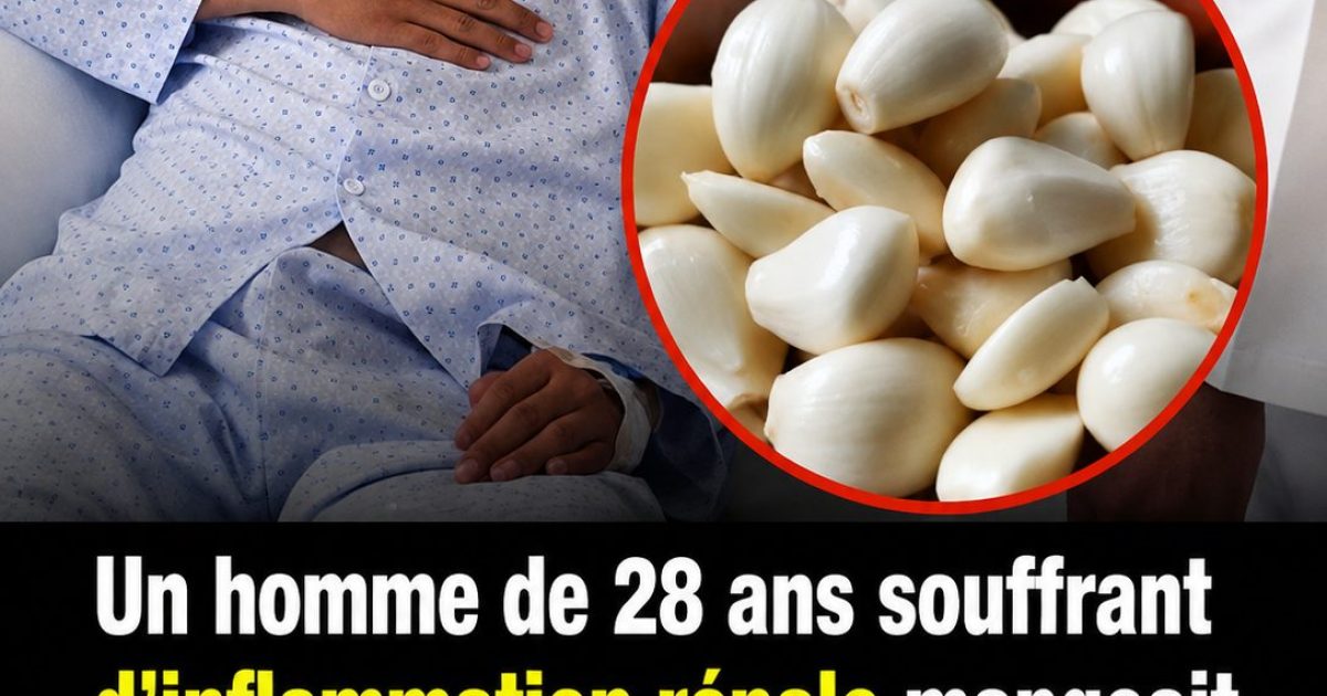 Il mangeait de l'ail tous les matins depuis 6 ans : ce que les médecins ont découvert est surprenant