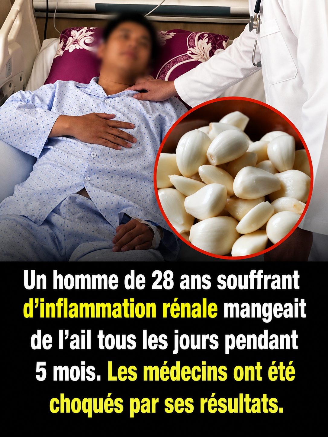 Il mangeait de l'ail tous les matins depuis 6 ans : ce que les médecins ont découvert est surprenant