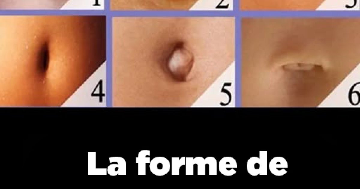 La forme de votre nombril révèle votre personnalité : découvrez ce qu'elle dit de vous