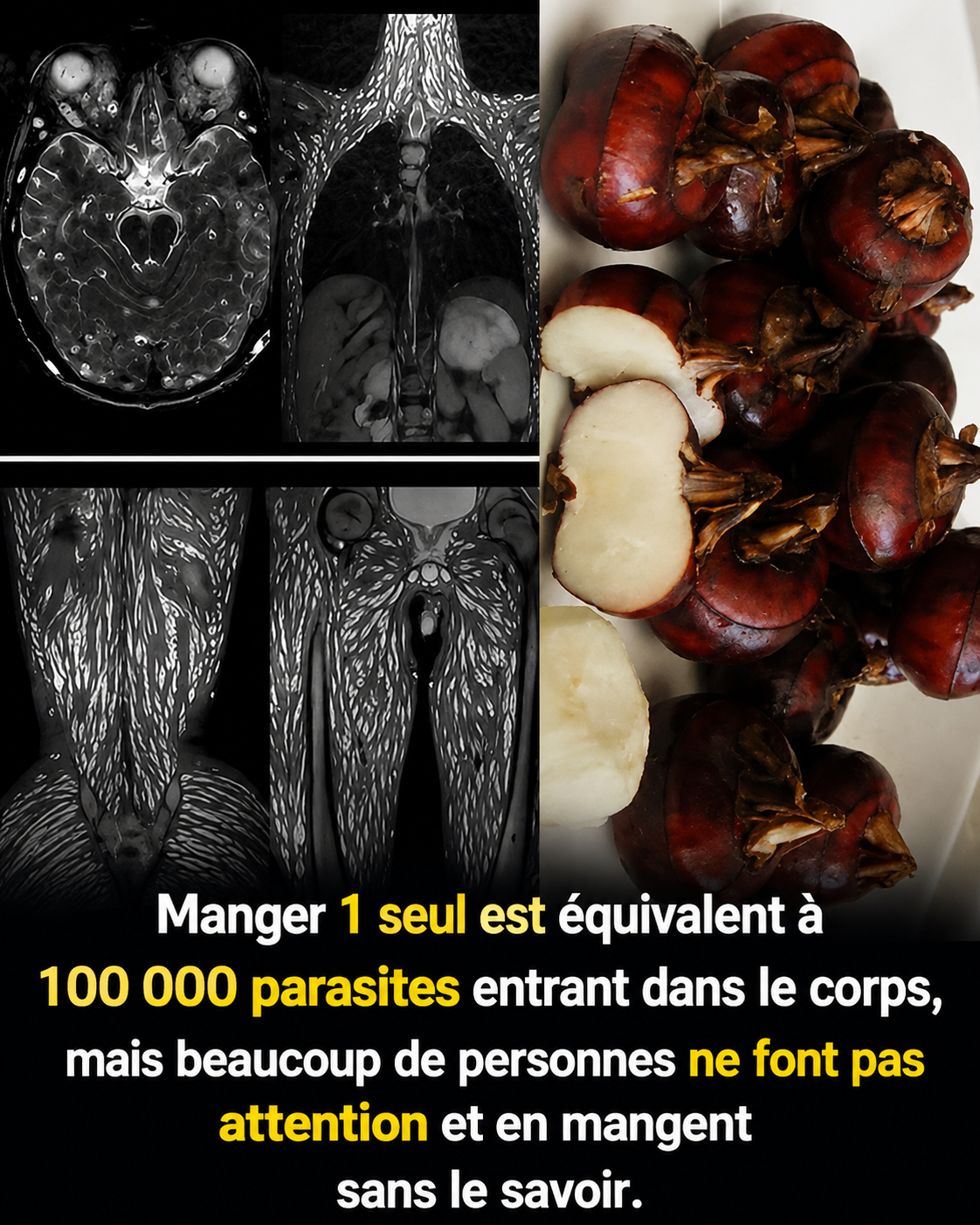 Ces aliments du quotidien qui peuvent cacher des parasites : ce que toutes les femmes devraient savoir