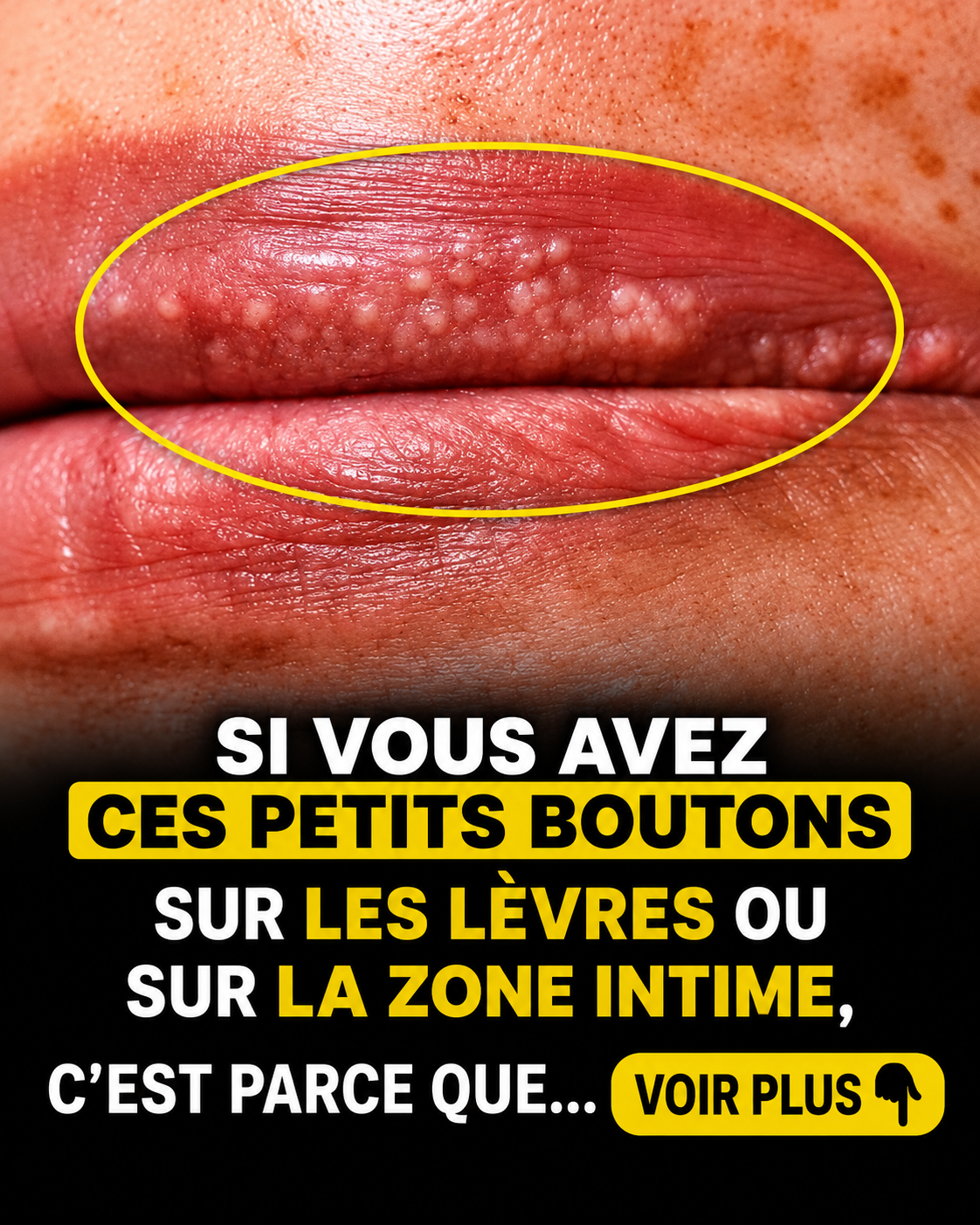 Petits boutons blancs sur les lèvres ou la peau sensible : ce qu'ils révèlent vraiment sur votre santé
