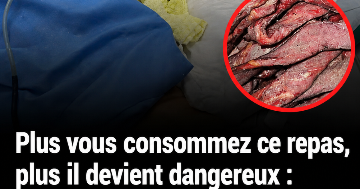Charcuterie et viandes transformées : ce que vous devriez vraiment savoir avant d'en manger chaque jour