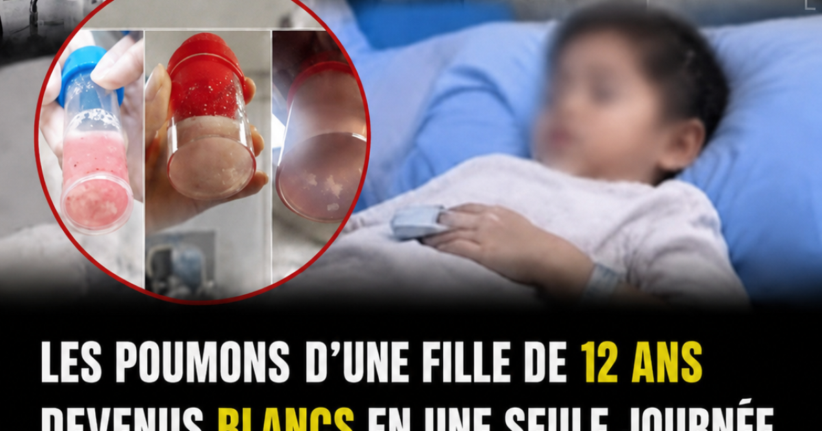 Poumon blanc en 24h après une simple fièvre : l'alerte des médecins que tous les parents doivent lire