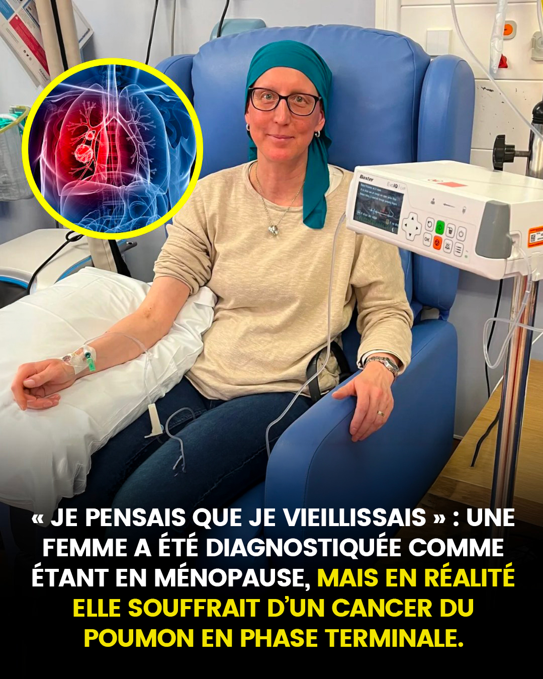 « Je pensais que je vieillissais » : une femme diagnostiquée ménopausée, mais atteinte en réalité d’un cancer du poumon en phase terminale