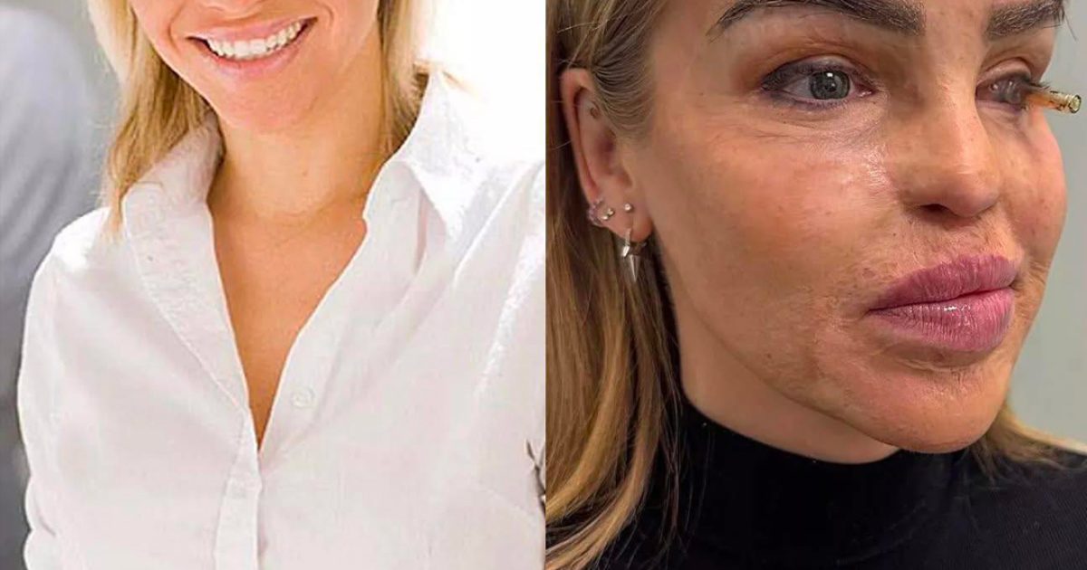 « J’en suis arrivée au bout du chemin » : le message émouvant de Katie Piper, la présentatrice de télévision qui a subi une violente attaque à l’acide il y a 16 ans