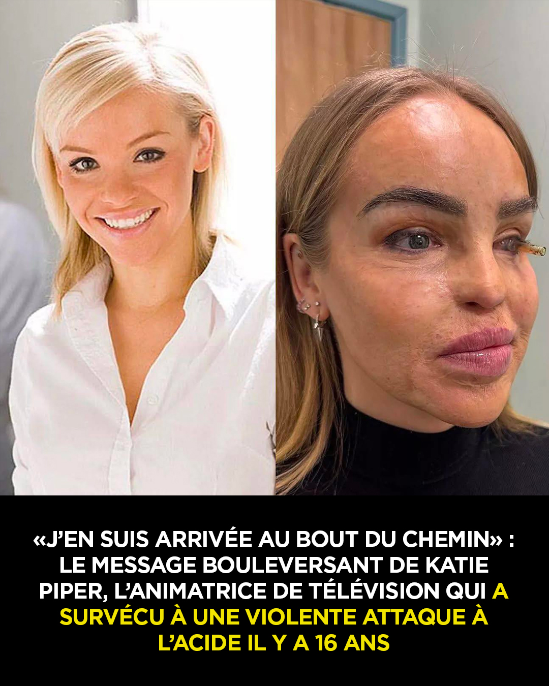 « J’en suis arrivée au bout du chemin » : le message émouvant de Katie Piper, la présentatrice de télévision qui a subi une violente attaque à l’acide il y a 16 ans
