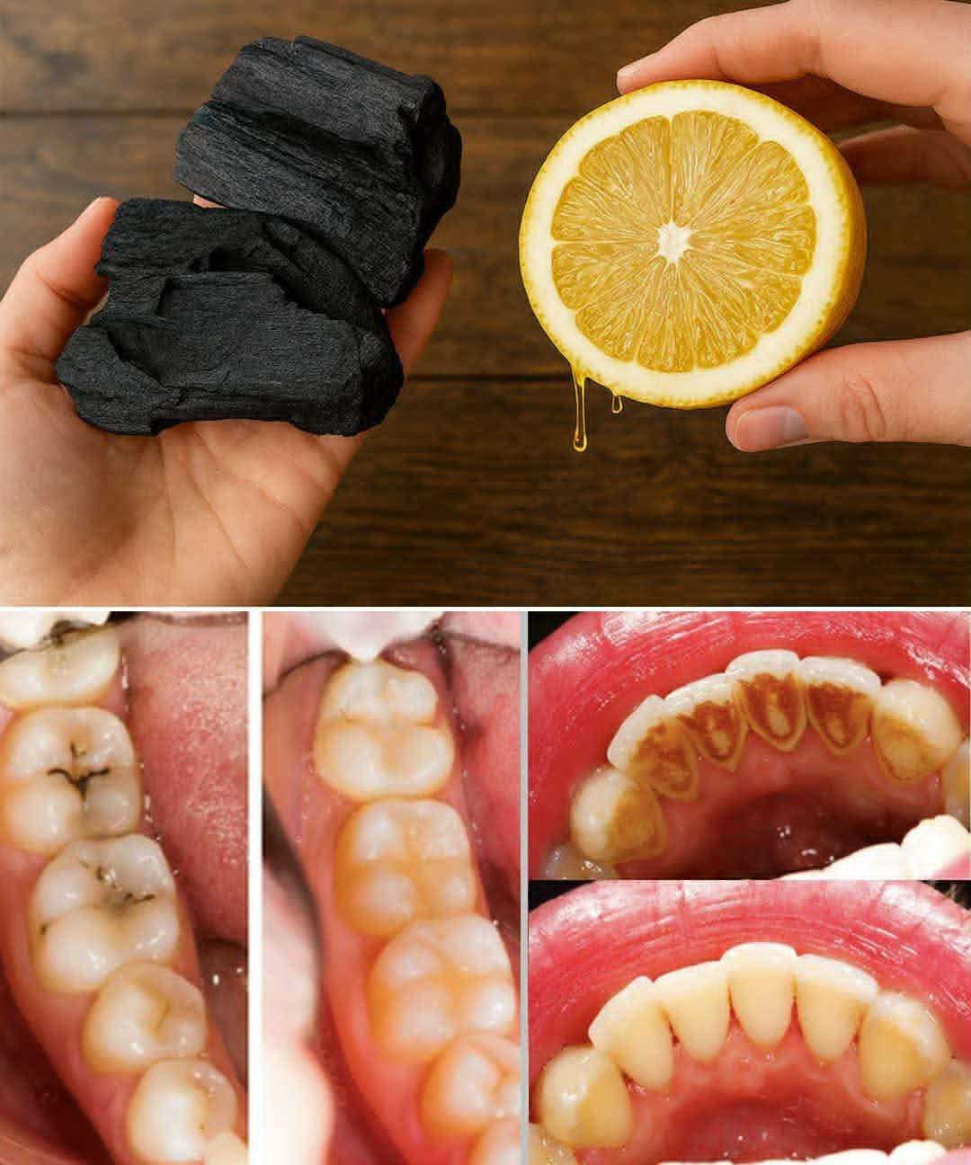 Jus de citron & charbon actif : les secrets naturels pour des dents saines