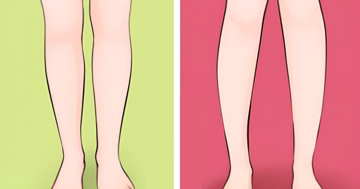 La vérité sur l’écart entre les cuisses : ce que cela révèle vraiment de votre corps