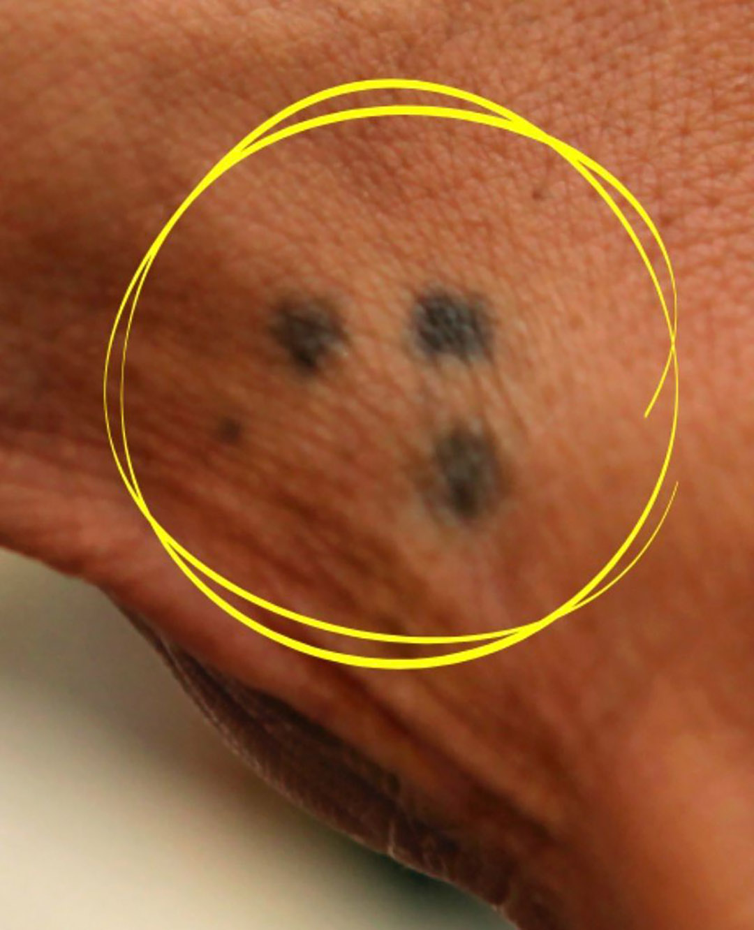 Le « tatouage à trois points » : signification et portée symbolique