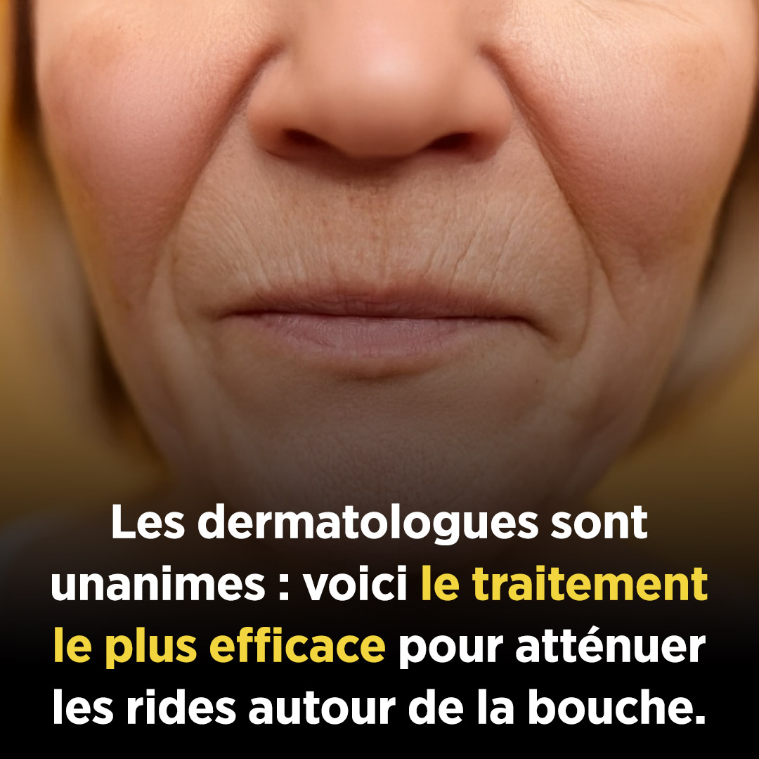 Les dermatologues sont unanimes : voici le traitement le plus efficace pour atténuer les rides autour de la bouche