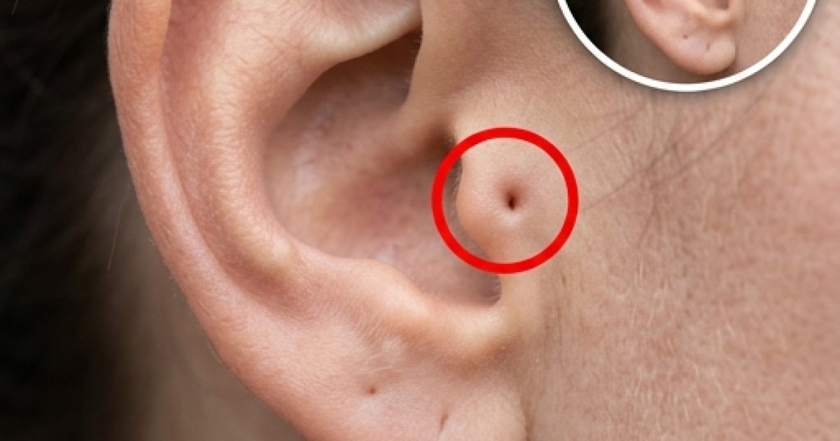 Les personnes qui ont cette marque sur l'oreille ont cette particularité