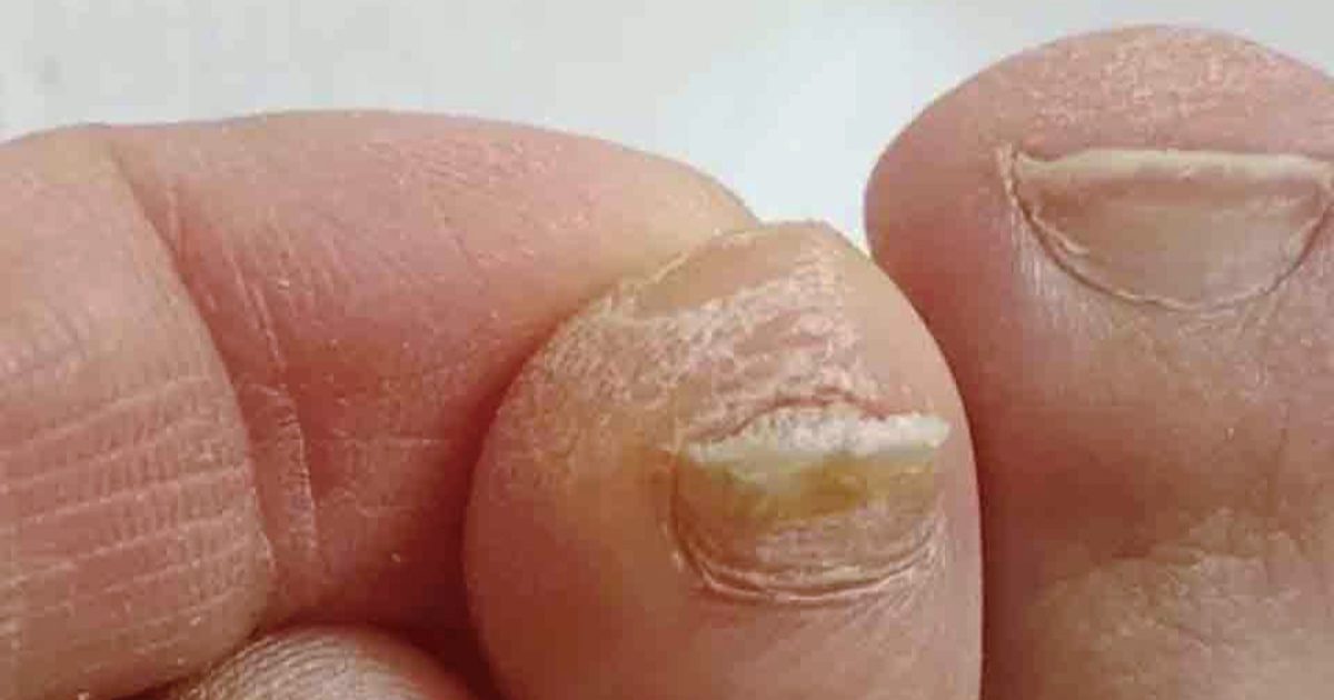 Ma grand-mère ne jure que par cette astuce pour atténuer l'épaisseur de ses ongles. Voici comment ça marche