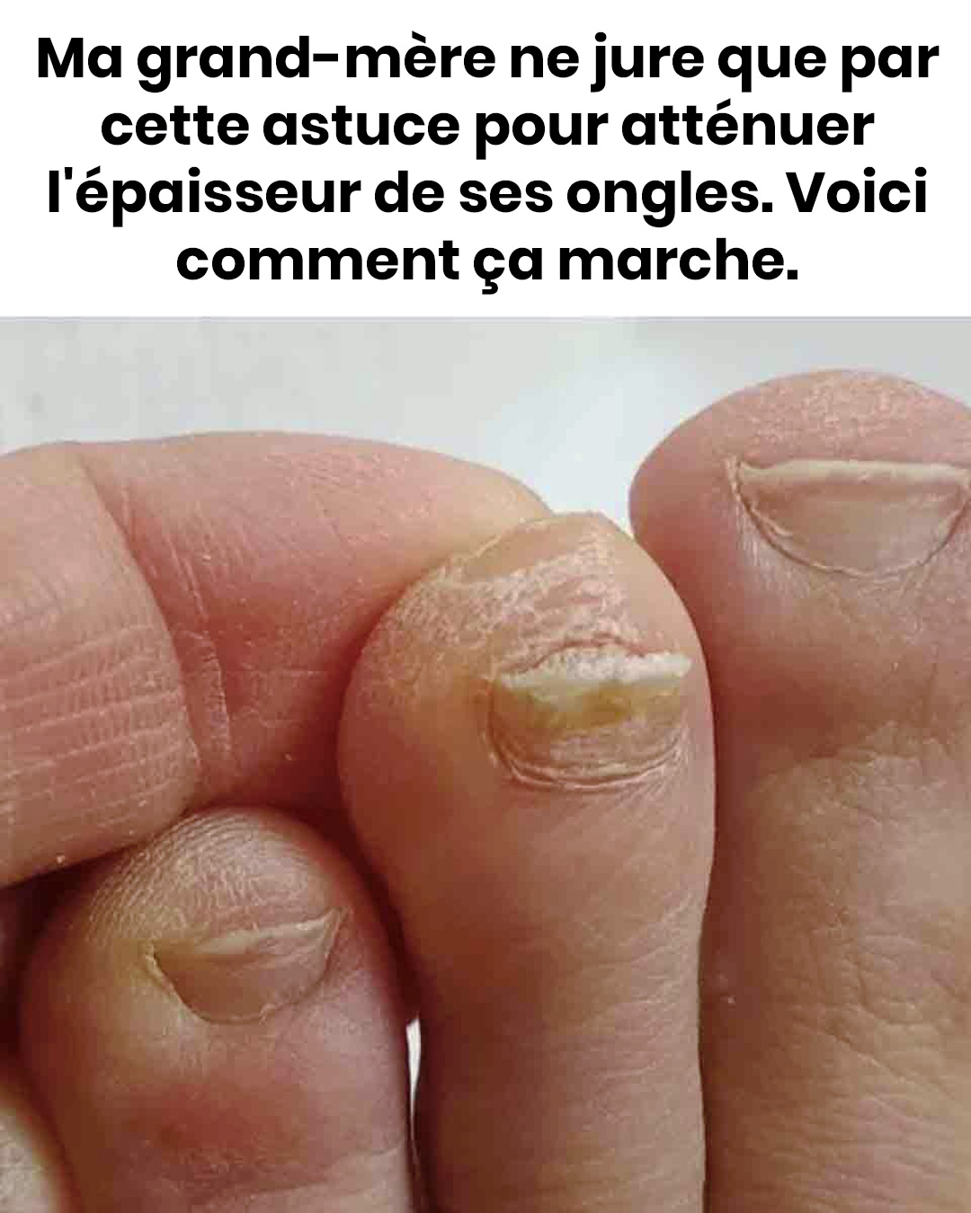Ma grand-mère ne jure que par cette astuce pour atténuer l'épaisseur de ses ongles. Voici comment ça marche