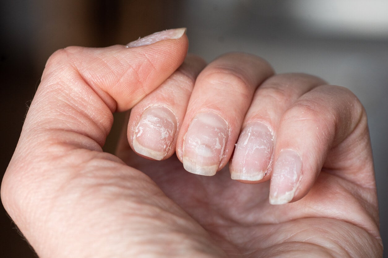 Santé : ces mystérieuses stries sur vos ongles qui en disent long sur votre corps