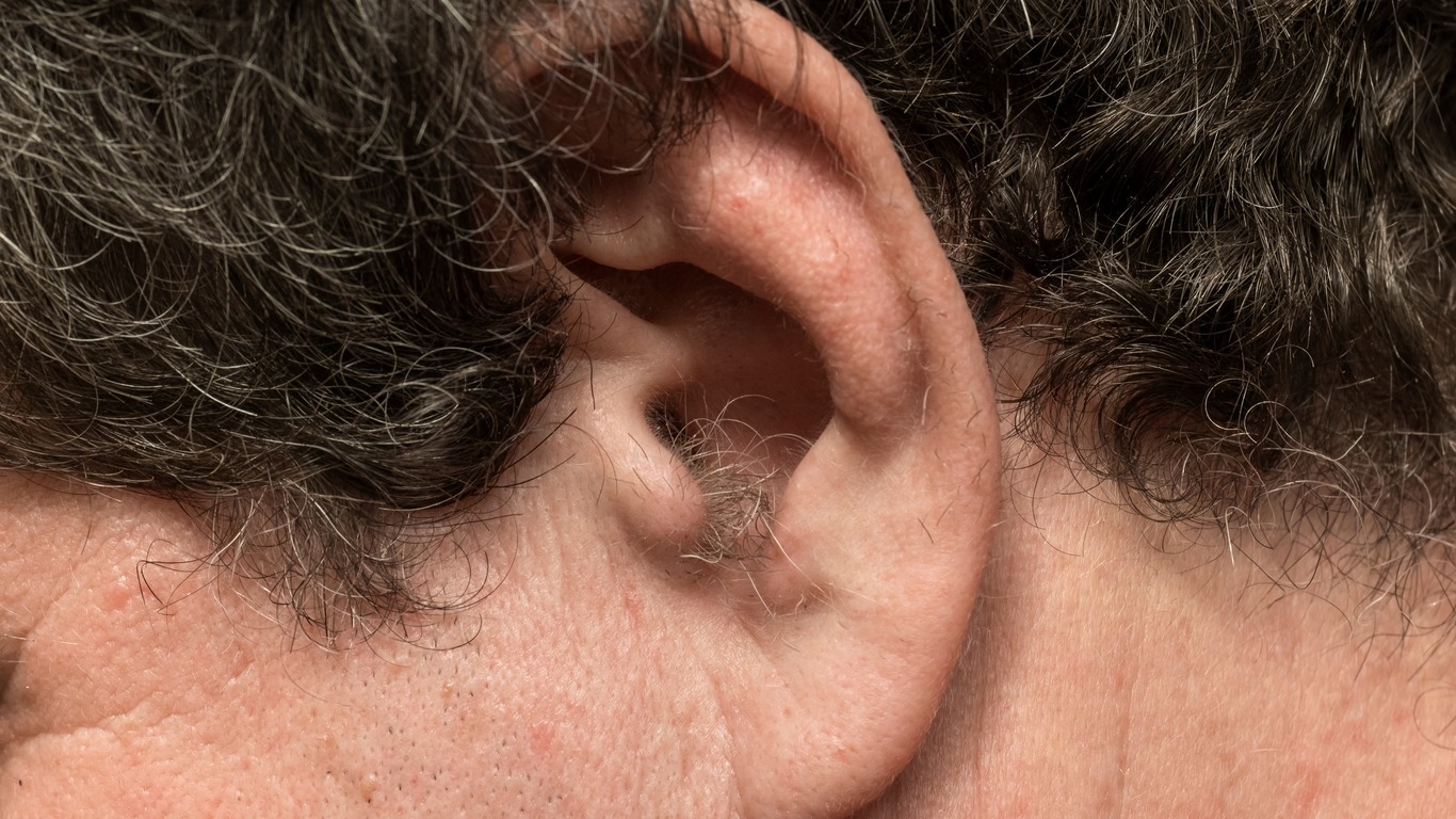 D’où viennent ces poils qui poussent soudainement dans vos oreilles ?
