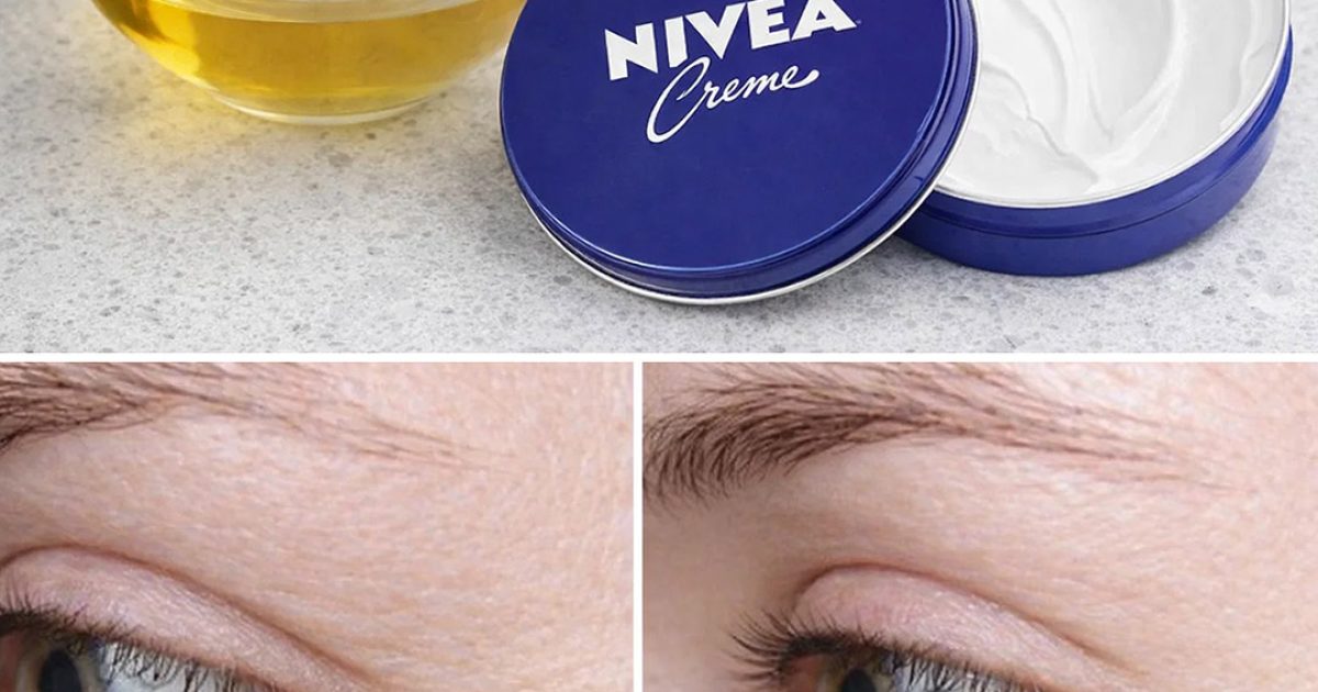 Mélangez de la crème Nivea et de l’huile d’olive pour rajeunir votre visage de 10 ans