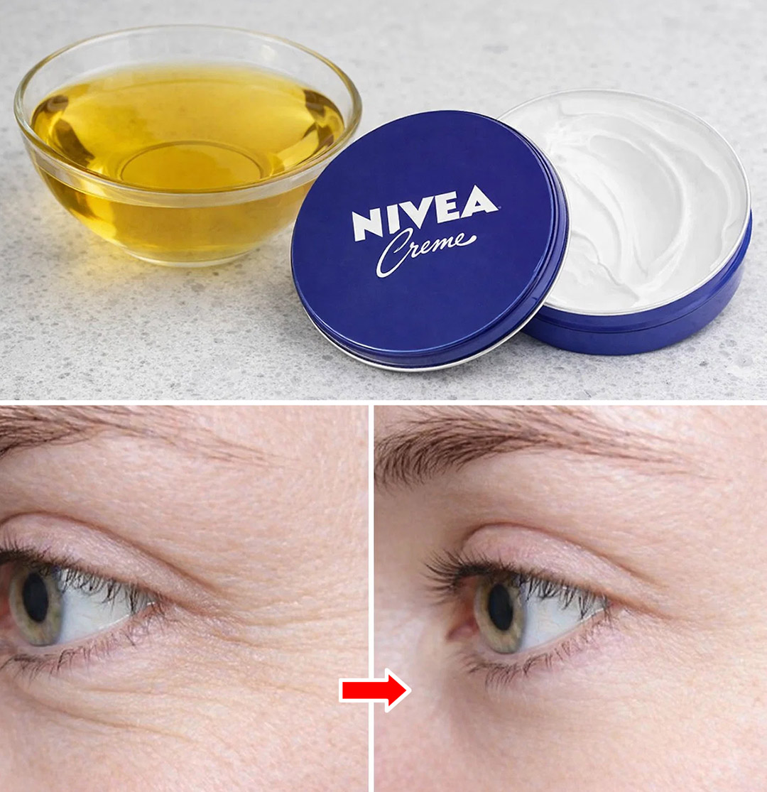 Mélangez de la crème Nivea et de l’huile d’olive pour rajeunir votre visage de 10 ans