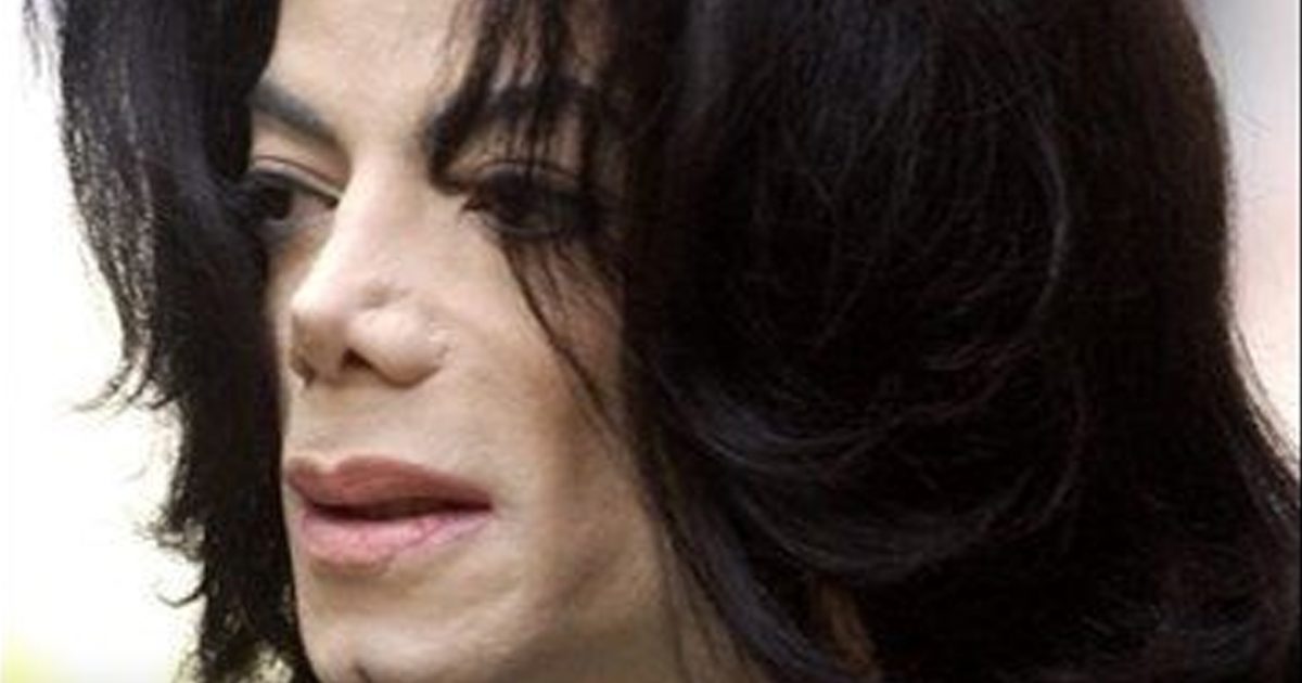 Michael Jackson : qu’est-ce que le vitiligo, la maladie qui touchait le roi de la pop ?