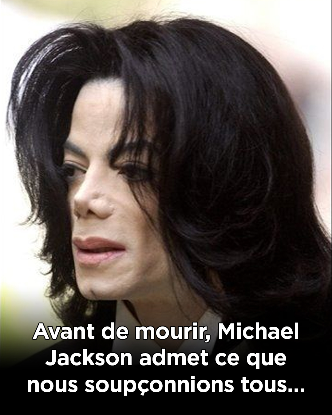 Michael Jackson : qu’est-ce que le vitiligo, la maladie qui touchait le roi de la pop ?