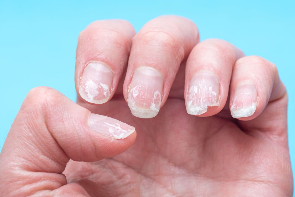 Vos ongles se brisent ? Ce signal discret que votre santé vous envoie