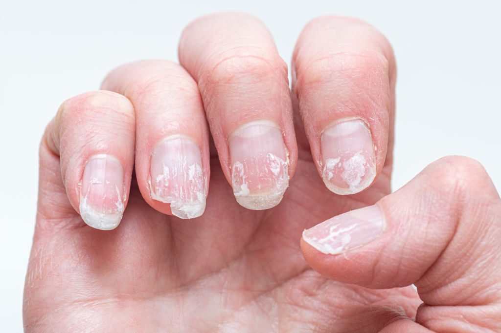 Vos ongles se brisent ? Ce signal discret que votre santé vous envoie