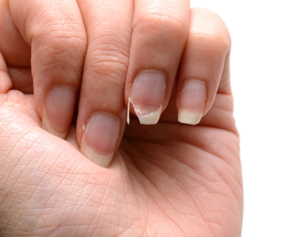 Vos ongles se brisent ? Ce signal discret que votre santé vous envoie