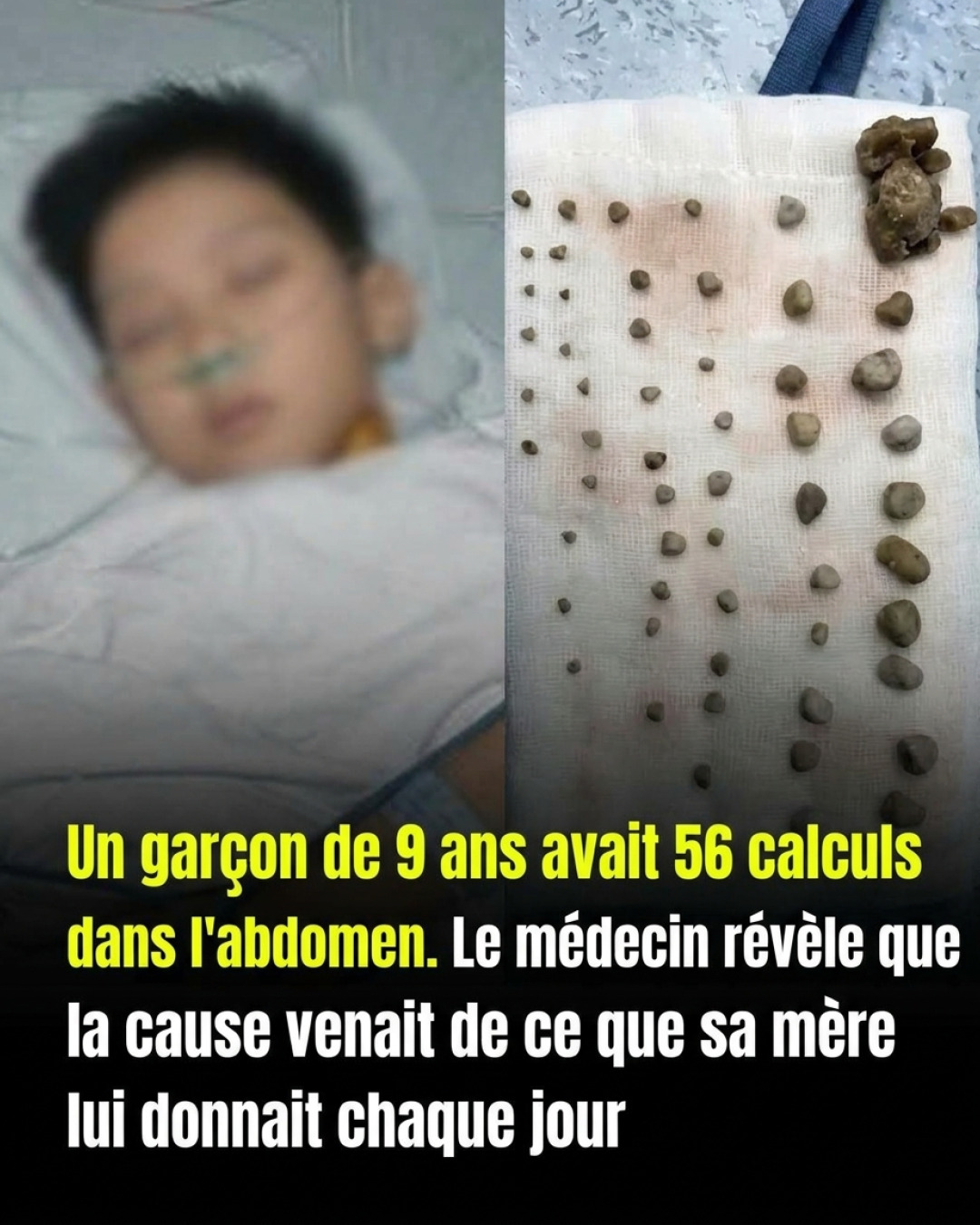 Calculs urinaires chez l'enfant : ce que chaque parent devrait absolument savoir