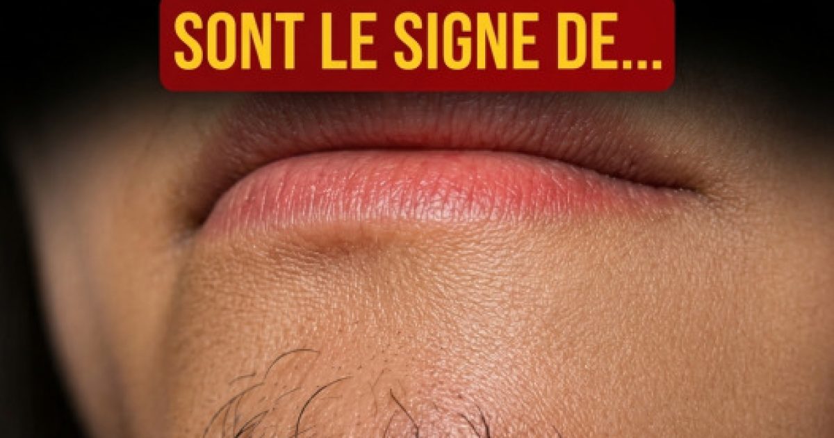 Poil sur le menton chez la femme : ce que votre corps cherche vraiment à vous dire