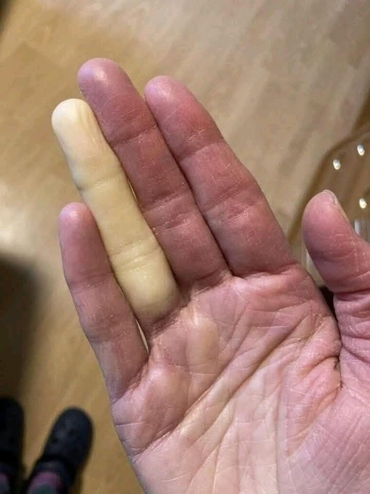 Doigts qui blanchissent dans le froid : ce que votre corps cherche à vous dire
