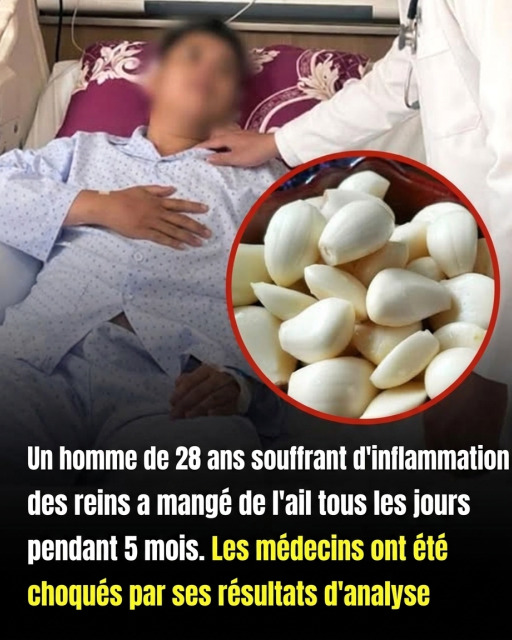 Il a mangé de l'ail tous les jours pendant 5 mois : voilà ce que les médecins ont constaté