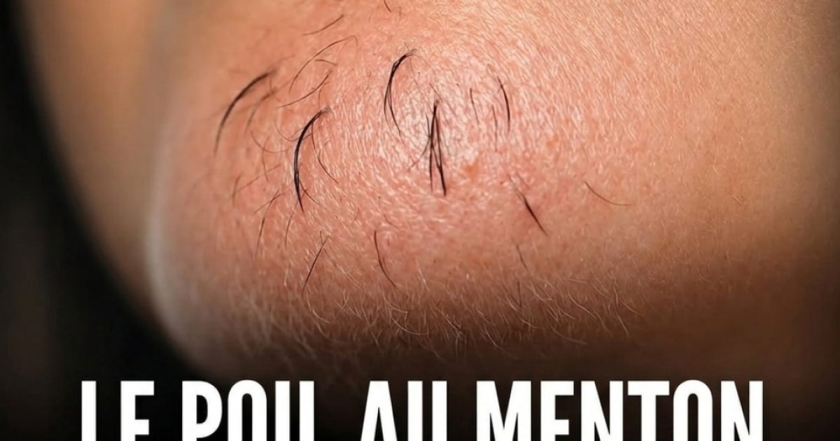 Poils sur le menton chez la femme : ce que votre corps essaie peut-être de vous dire