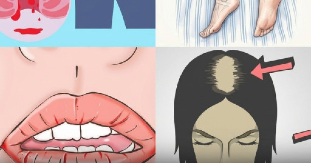Vitamine B12 : 8 signaux surprenants que votre corps vous envoie en ce moment