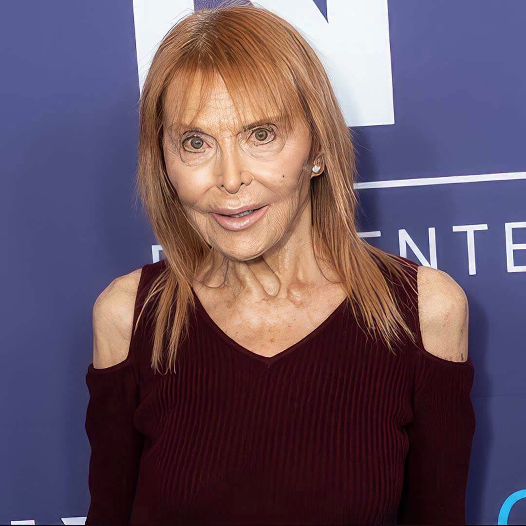 Brigitte Bardot, Mickey Rourke, Meg Ryan… Ces stars d'hier que vous ne reconnaîtriez plus aujourd'hui