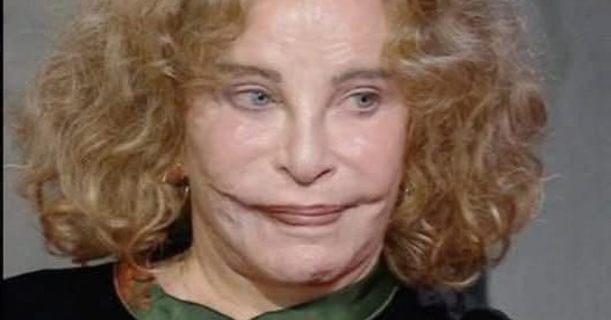 Sydne Rome, star oubliée des années 70 : comment elle a tout surmonté après un accident qui a changé son visage