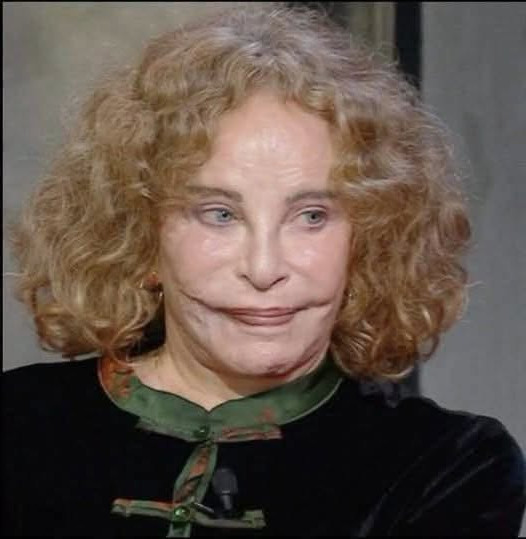 Sydne Rome, star oubliée des années 70 : comment elle a tout surmonté après un accident qui a changé son visage