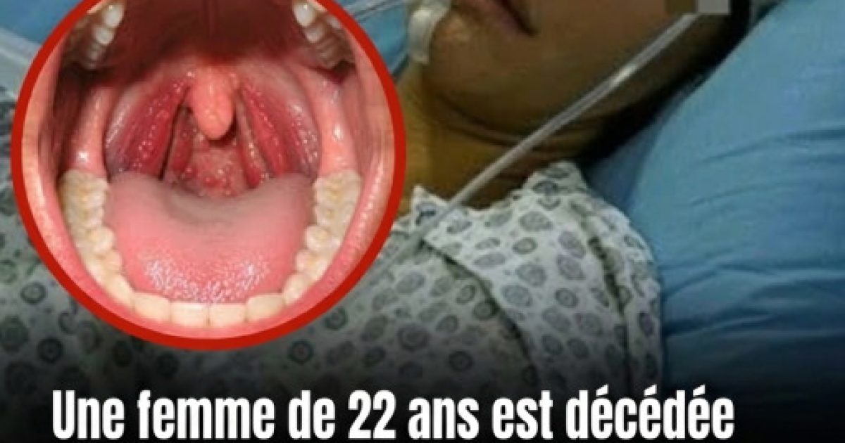 Mal de gorge : 5 signes qui doivent vous alerter immédiatement
