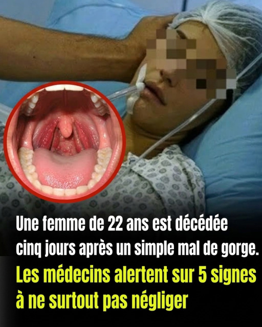 Mal de gorge : 5 signes qui doivent vous alerter immédiatement
