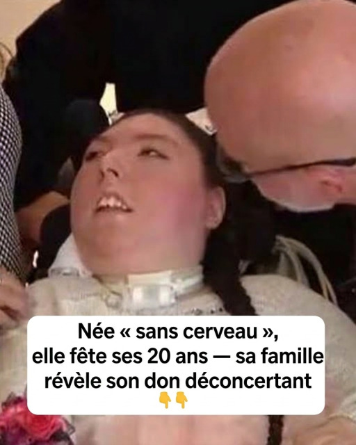 Née sans cerveau, Alex fête ses 20 ans : l'incroyable histoire d'une jeune femme qui a défié tous les pronostics